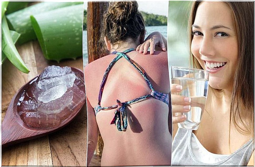 9 emergency measures to treat sunburn