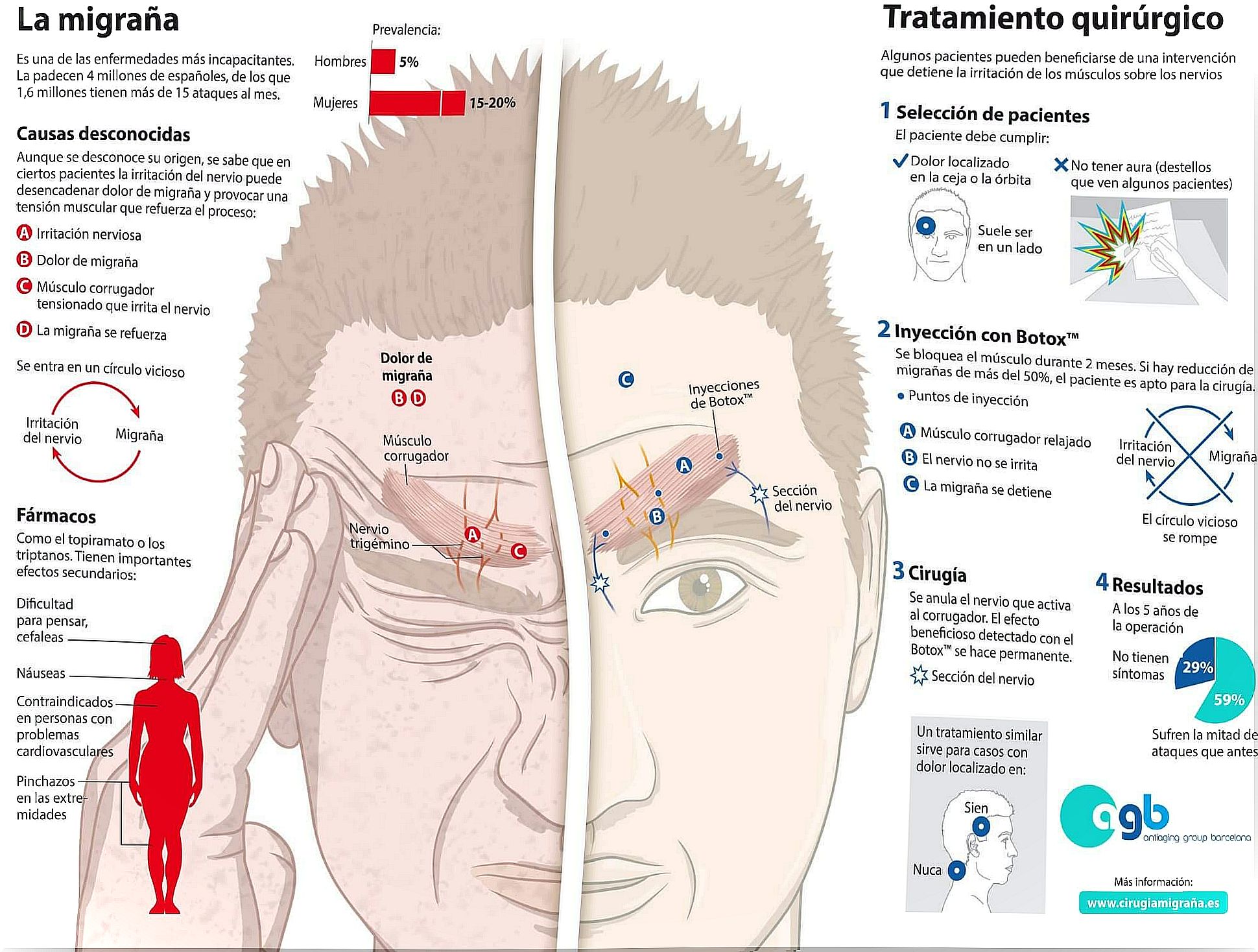 chronic migraines