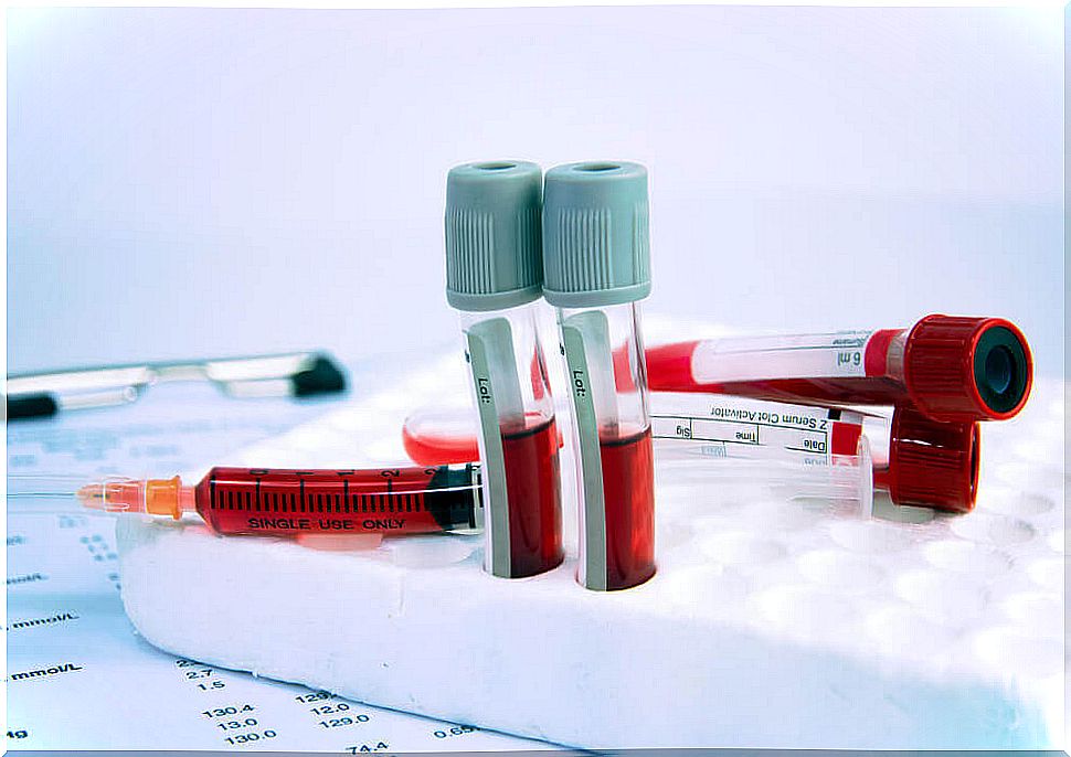 Blood in test tubes and syringes