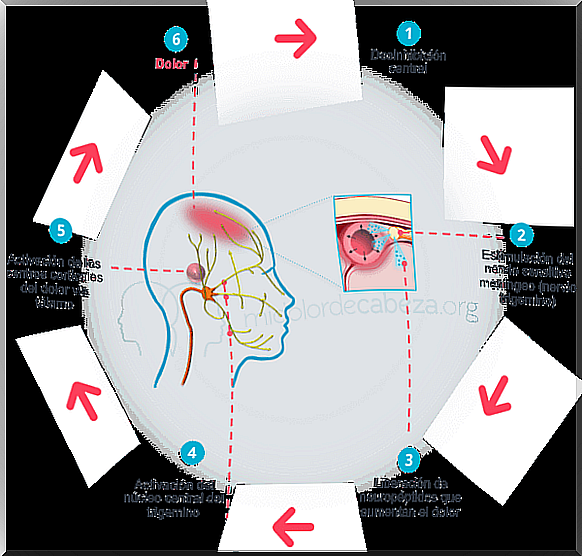 Migraine pain cycle