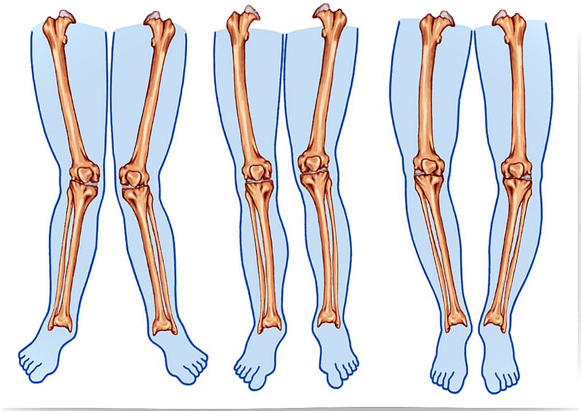 Types of legs.