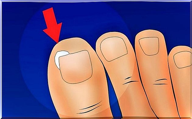 How to avoid ingrown nails