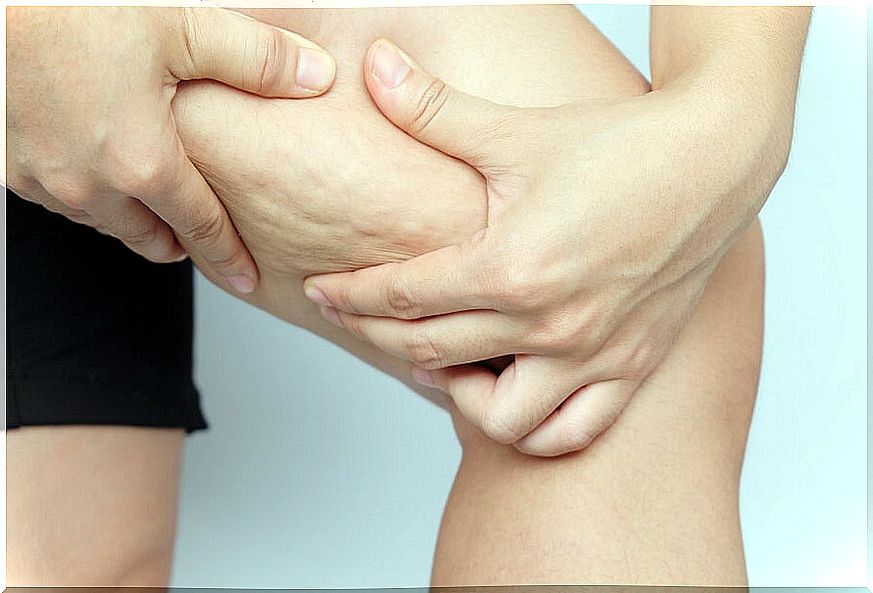 How to get rid of cellulite: 5 alternative solutions