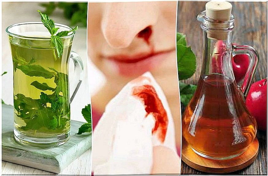 How to stop nosebleeds with 5 natural remedies