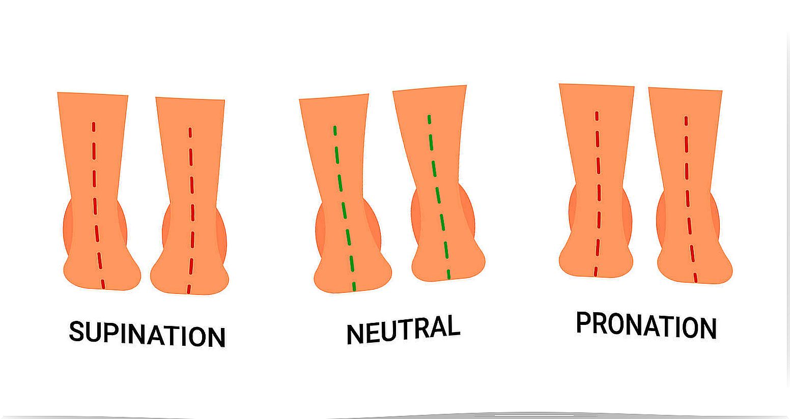 Supination and pronation are gait abnormalities.