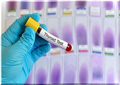 Analysis to measure thyroxine and TSH concentrations and to be able to adjust the treatment of hypothyroidism.