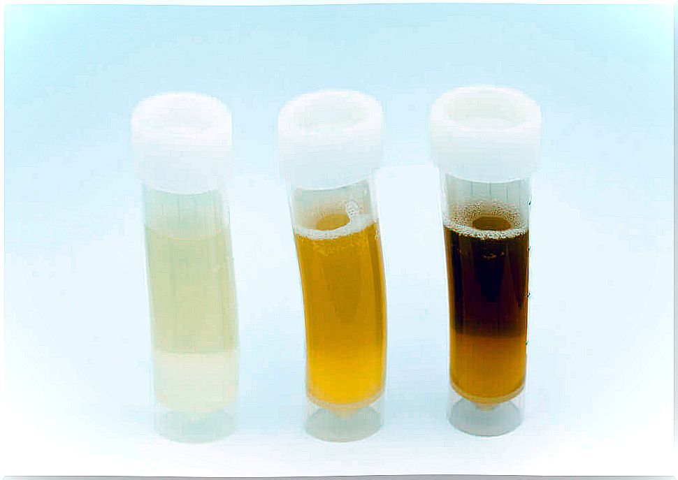 What can be found in a urine test after physical exercise?