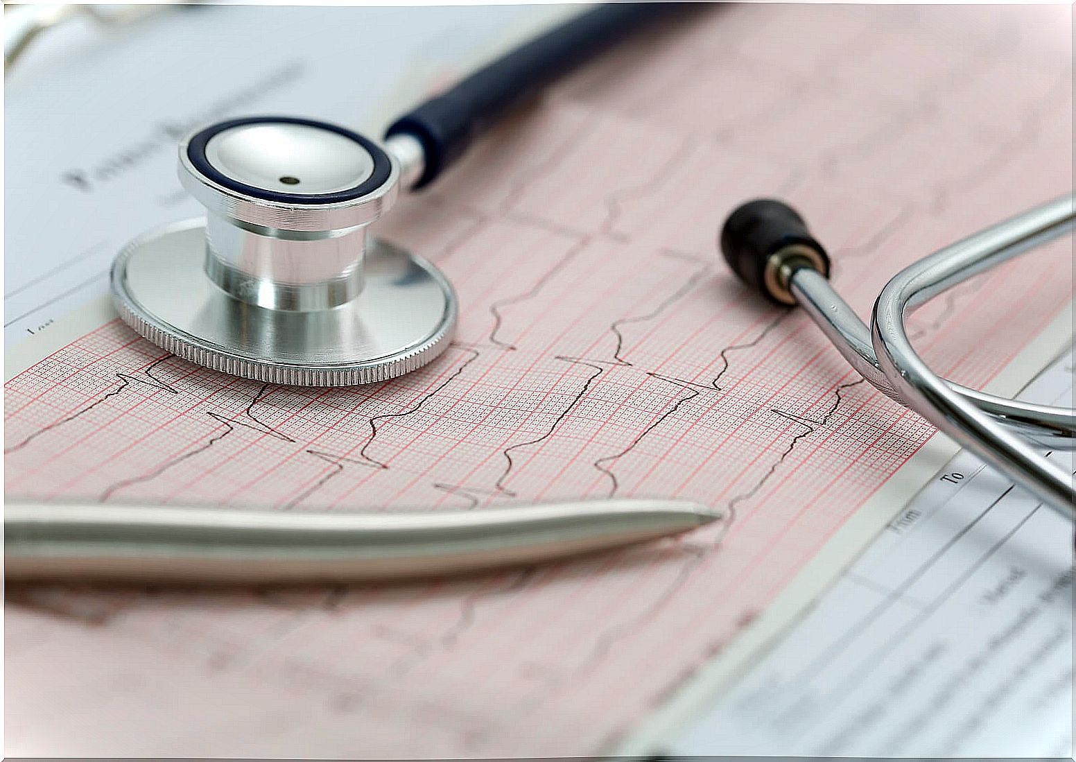 What you did not know about cardiac arrhythmias